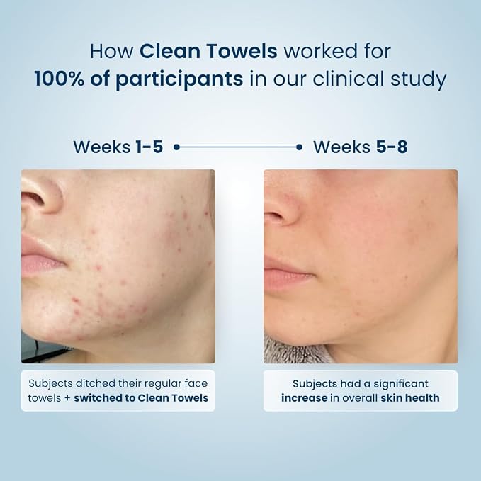 Clean Skin Club Clean Towels®, 100% USDA Biobased Face Towel, Disposable Face Towelette, Eczema Association Accepted, Makeup Remover Dry Wipes, Ultra Soft, 25 ct per pack, 2 Packs, 50 Ct Total