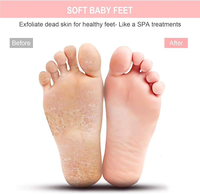 BESKAR XL Large Foot Scrubber Mat for Use in Shower - Shower Foot Cleaner to Eliminate Calluses Dead Skin, Foot Massager Mat for Men & Women to Soothe Achy Feet, Non Slip Suction Cups | Cleans, Smooths, Exfoliates, Massages Your Feet Without Bending, I...