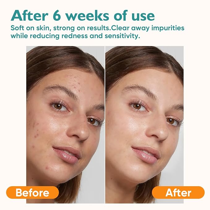UNIMADE Face Towels, 100 Count Disposable Face Towelette for Washing Face, Skincare, Ultra Soft Facial Towel for Sensitive Skin, Lint-free Makeup Remover Dry Wipes - 2 Box